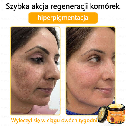 【Oficjalny sklep flagowy】Foulme® Profesjonalny krem do usuwania jadu pszczelego