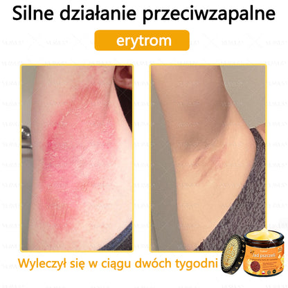 【Oficjalny sklep flagowy】Foulme® Profesjonalny krem do usuwania jadu pszczelego