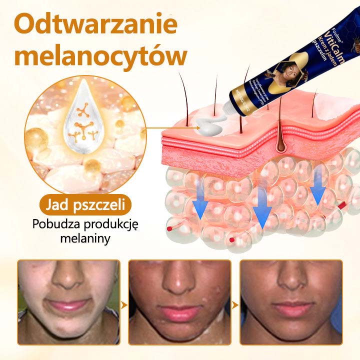 Foulme® VitiCalm krem z jadem pszczelim🐝🐝