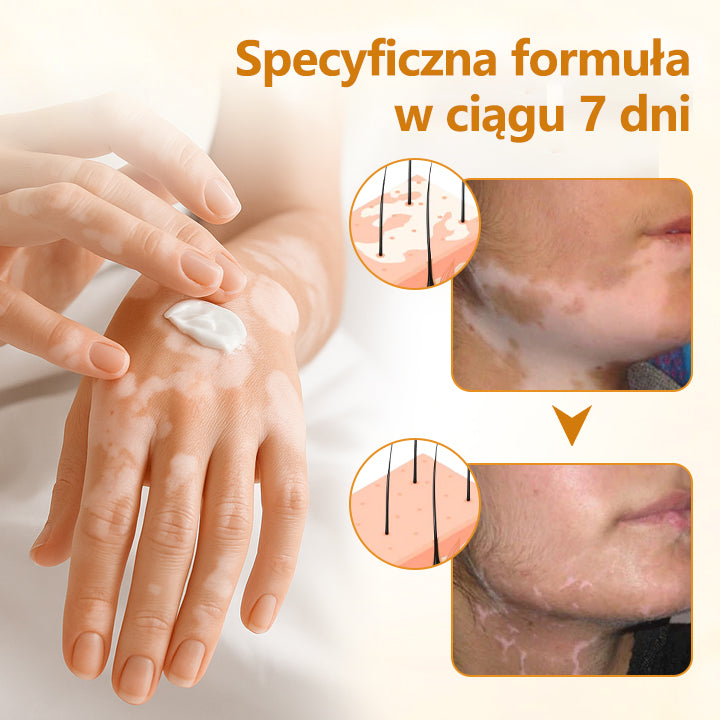 Foulme® VitiCalm krem z jadem pszczelim🐝🐝