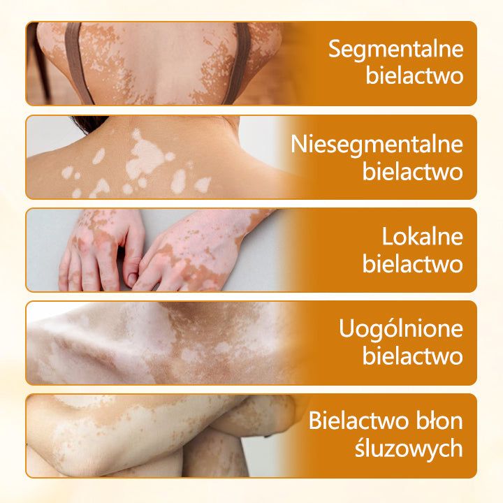 Foulme® VitiCalm krem z jadem pszczelim🐝🐝