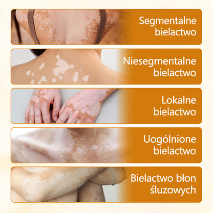 Foulme® VitiCalm krem z jadem pszczelim🐝🐝