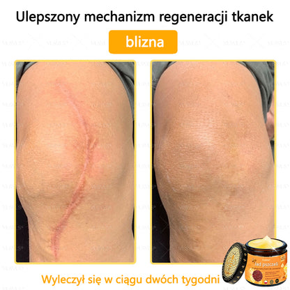 【Oficjalny sklep flagowy】Foulme® Profesjonalny krem do usuwania jadu pszczelego