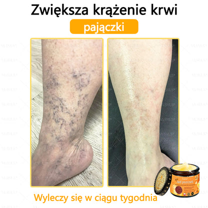 【Oficjalny sklep flagowy】Foulme® Profesjonalny krem do usuwania jadu pszczelego
